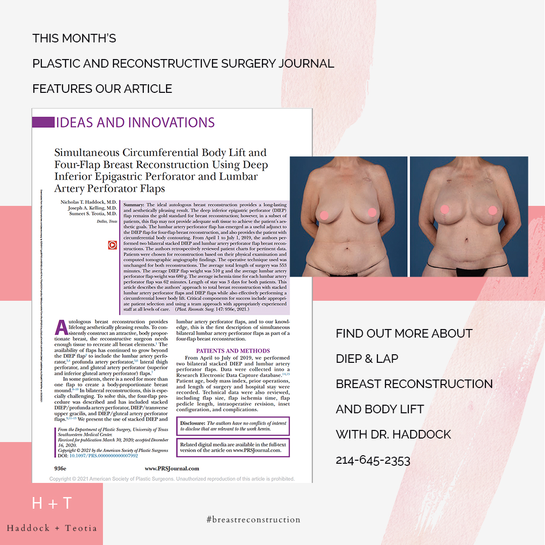 Featured image for “Simultaneous DIEP flap and LAP Flap”