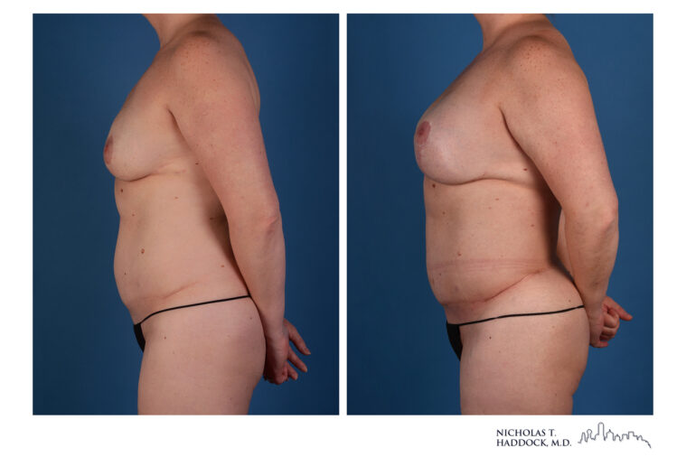 RB_197_LT LAT_Post 2Y 8M_WEB
