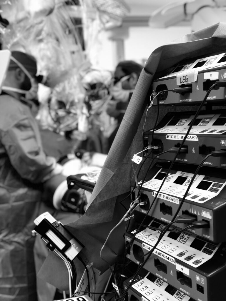 Four electrosurgical generators in an operating room, each labeled by station: leg, right breast, left breast, right abdomen.